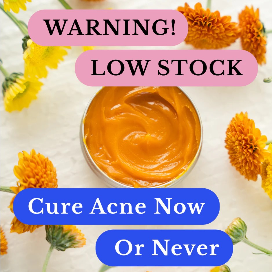 Kill Acne & Redness Ritual-Limited-Time🌲 Christmas Sale: 50% Off🎁