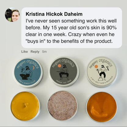 Kill Acne & Redness Ritual-Limited-Time🌲 Christmas Sale: 50% Off🎁