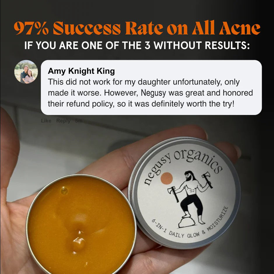 Kill Acne & Redness Ritual-Limited-Time🌲 Christmas Sale: 50% Off🎁