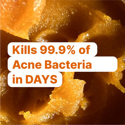 Kill Acne & Redness Ritual-Limited-Time🌲 Christmas Sale: 50% Off🎁