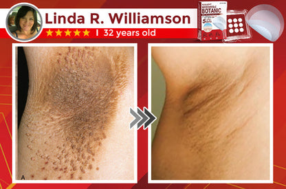 NEGUSY™ Removal Patch: Gentle Microneedle Patches for SkinTag & Mole Removal