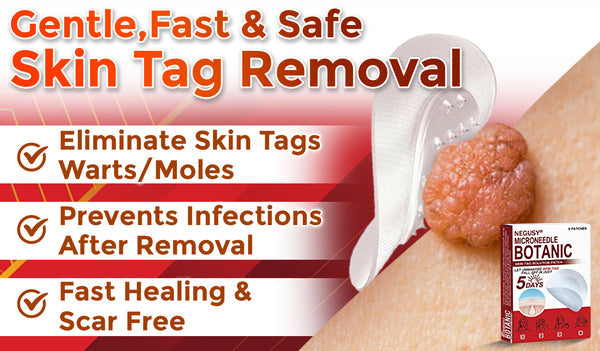 NEGUSY™ Removal Patch: Gentle Microneedle Patches for SkinTag & Mole Removal