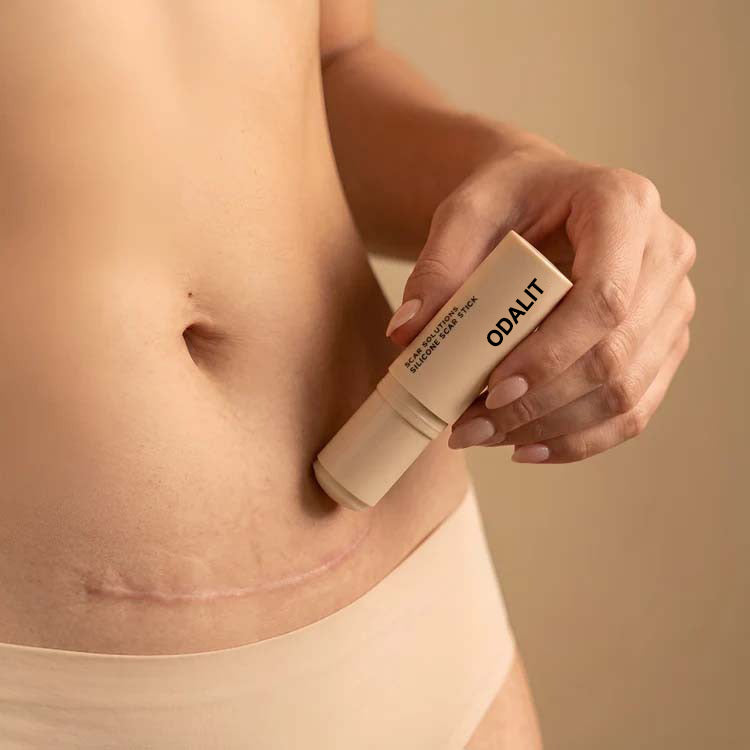 ODALIT™ Silicon ScarStick Limited Time 75%OFF Buy 1 Get 2 Free🔥LAST DAY⏰