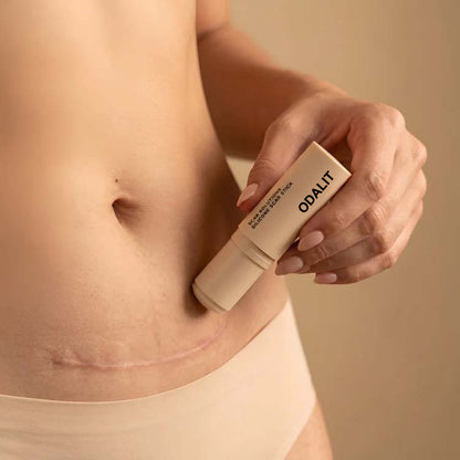 ODALIT™ Silicon ScarStick Limited Time 75%OFF Buy 1 Get 2 Free🔥LAST DAY⏰